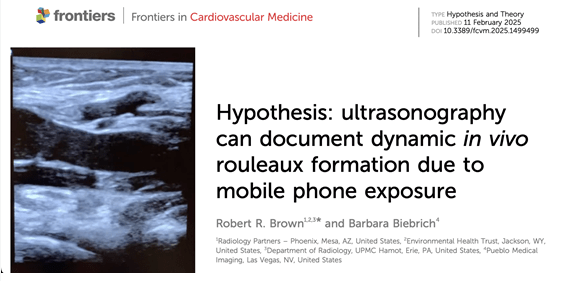 Ultrasound Study Reveals Wireless Radiation Can Cause 
Blood Cells to Stick Together.